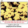    (Staphylococcus aureus)